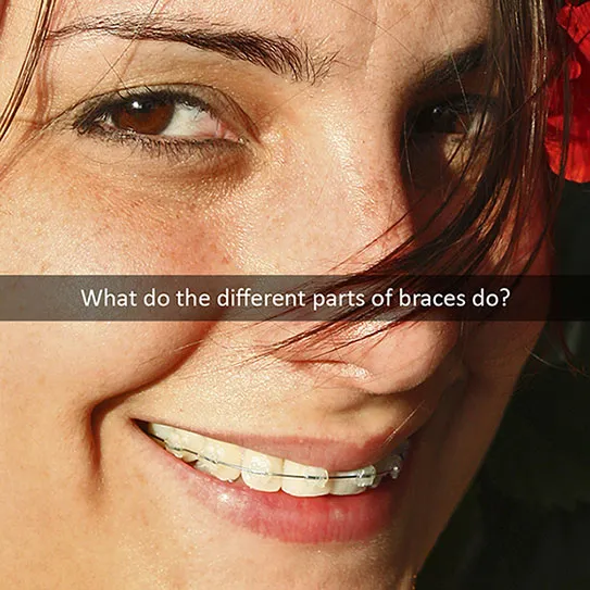 braces-anatomy close view