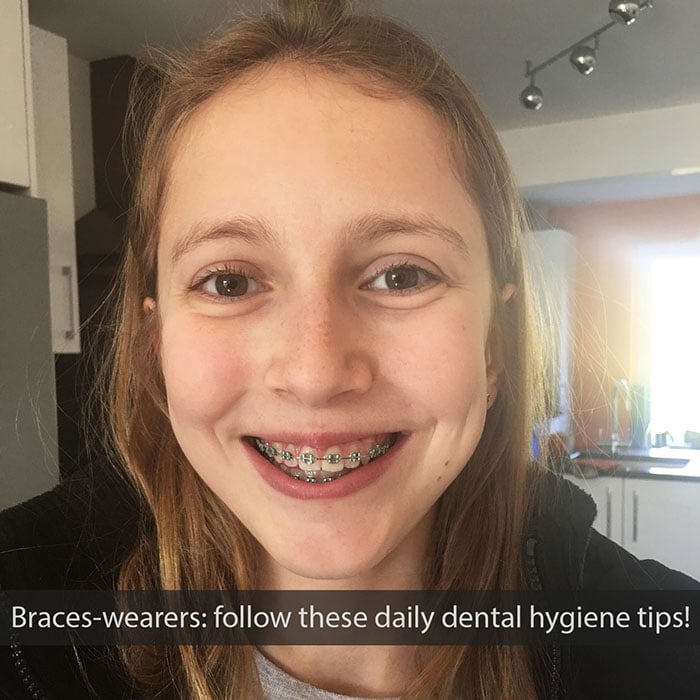 daily-braces-care