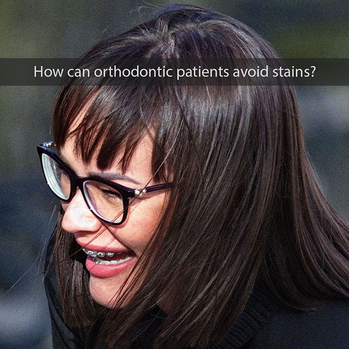 orthodontic-stains
