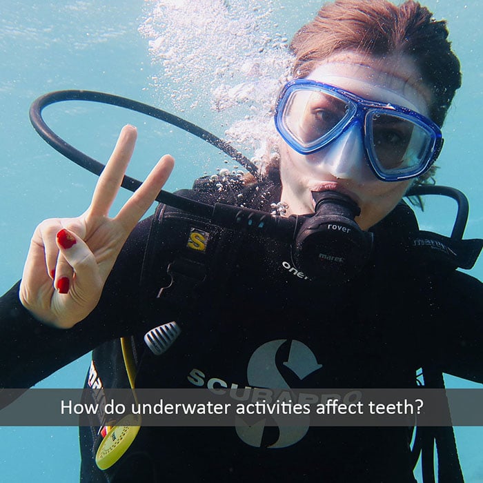 underwater-teeth